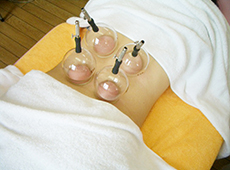 カップ(吸玉)吸引療法